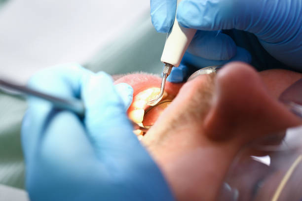 Best Emergency Wisdom Teeth Removal in Highland Park, TX