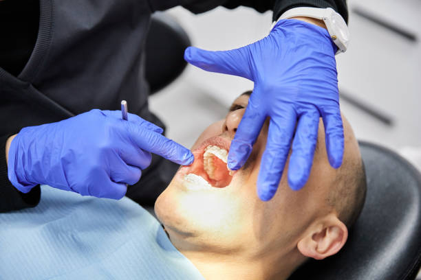 Best Emergency Tooth Extraction in Highland Park, TX